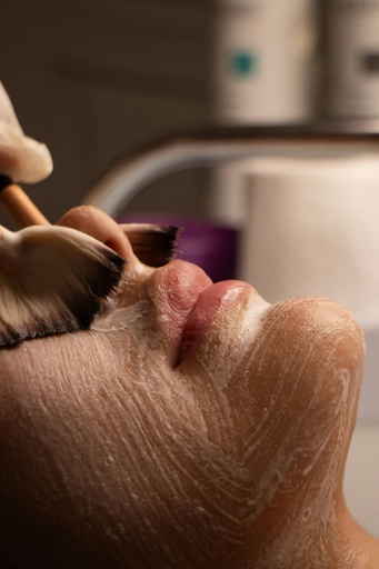 Carbon Laser Facial